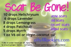 scar be gone recipe infographic. http://younglivingoilobsessed.wordpress.com/ https://www.facebook.com/YoungLivingOilObsessed?ref=hl Young Living Acne, Oils For Scars, Yl Oils, Acne Scar, Yl Essential Oils, Essential Oils For Skin, Patchouli Essential Oil, Living Essentials Oils, Living Essentials