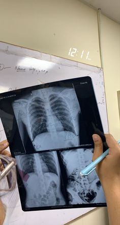 a person is doing an x - ray in front of a whiteboard