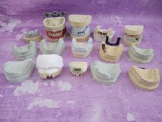 Vintage Dental Plaster Teeth Molds LOT Dentist Cast Impressions Oddity Halloween Wonderful Things, Medical Supplies, Molding, Happy Shopping, Buy Online, Medical, It Cast, Collectibles, Halloween