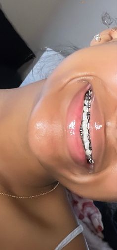 Pretty Teeth With Braces, Briblixks Pics, Braces And Lipgloss, Braces Colors Light Skin, Braces For Black Women, Braces Aesthetic Girl Black, Braces Manifestation, Pink Braces Black Women, Braces Colors Black Women