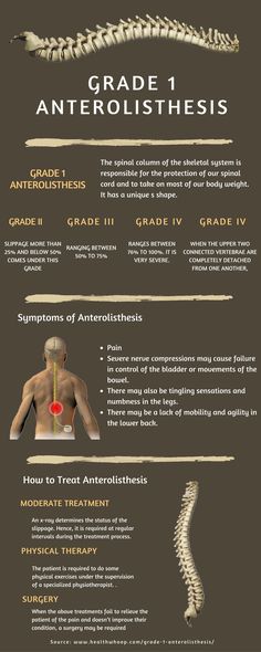 Lumbar Exercises, The Skeletal System, Cervical Disc, Bulging Disc, Spinal Column, Hip Problems, Aging Backwards, Tight Hip Flexors, Nursing School Studying