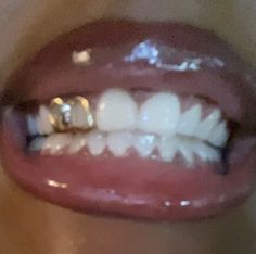 Pretty Teeth, Dental Jewelry, Grillz Teeth, Diamond Teeth, 50k Followers, Dope Jewelry Accessories, Grills Teeth, Tooth Gem, Gold Teeth