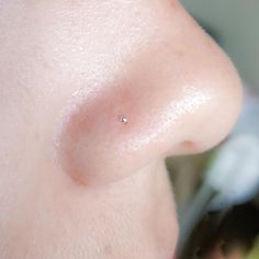 a woman's nose is shown with small white dots on the side of her nose