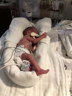 a baby laying in a hospital bed with an iv attached to it's back