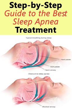 Don't let sleep apnea steal your rest! Learn about common signs like loud snoring, daytime sleepiness & morning headaches. Talk to your doctor for a healthy sleep! 
#sleepbetter #breathingproblems #consultdoctor #healthyhabits Daytime Sleepiness, Sleep Studies, Breathing Problems, Low Mood, Sleep Health