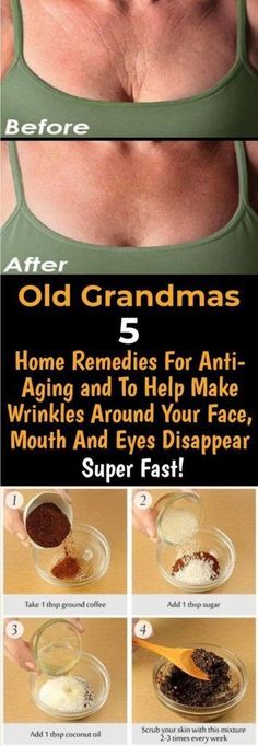 Old Grandmas 5 Home Remedies für Anti-Aging und helfen, Falten um Gesicht, Mund... ,  #AntiAging #falten #für #Gesicht #Grandmas #helfen #Home #Mund #Remedies #und Check more at https://hautpflege.naa7.com/old-grandmas-5-home-remedies-fur-anti-aging-und-helfen-falten-um-gesicht-mund/ Coconut Oil Scrub, Mouth And Eyes, Forehead Wrinkles, Beauty Remedies, Anti Aging Skin, Beauty Tricks, Skin Products, Anti Aging Skin Products