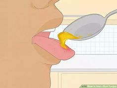 Lie Bumps On Tongue Remedy, Cold Sore On Tongue, Lie Bumps On Tongue, Blister On Tongue, Canker Sore On Tongue, Bumps On Tongue, Sore Tongue, Tongue Problems