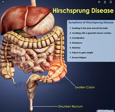 an image of the human stomach and its major organ systems, including the large intestructions