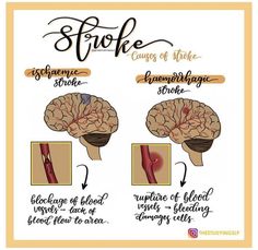 Speech Language Pathology Anatomy, Speech Pathology Aesthetic, Slp Anatomy, Neuro Anatomy, Slp Aesthetic, Brain Anatomy And Function, Praxis Study