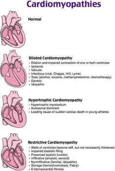 an image of the heart and its corresponding functions in cardiomyopathies chart