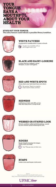 Health Infographic, Kedokteran Gigi, Tongue Health, Oil Pulling, Nail Health, Dental Hygiene, Health Info, Oral Hygiene, Oral Health