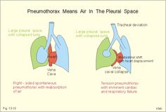 the lungs are labeled with different areas in each part of the body and their corresponding organs