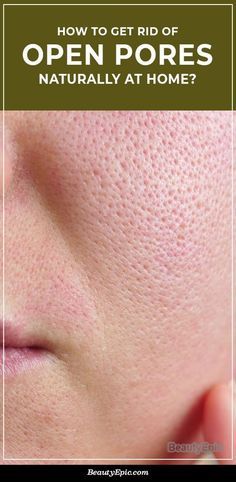 Minimize Pores Naturally, Big Pores, Face Pores, Smaller Pores, Make Up Videos, How To Get Rid Of Pimples