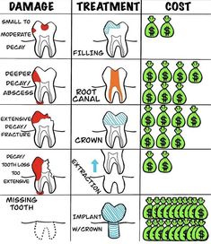 Dental Comics, Dental Posters, Dental Hygiene School, Dentistry Student, Dental Fun