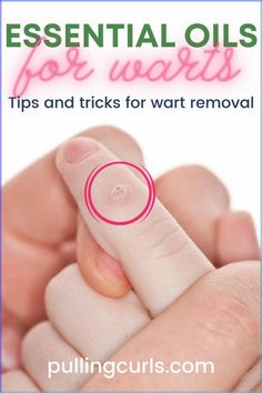 Warts CAN be fixed at home, just as easily as at the doctor's office. Using essential oils for warts is an easy and effective way to remove warts at home. #NaturalHerbalRemedies #NaturalRemediesForCold Essential Oils For Warts, Oils For Warts, Essential Oils Warts, Wart On Finger, Warts On Hands, Home Remedies For Warts, Warts Remedy, Cold Sore Remedies, Wart Remover