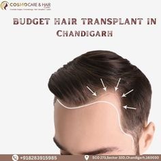 In this blog, we'll explore the world of Budget Hair Transplant In Chandigarh and how Cosmo Care & Hair Clinic can help you reclaim your confidence at a price that fits your wallet.