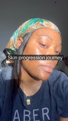 Hyperpigmentation Mask, French Skincare, Makeup Quotes, Cleanse Your Body, Smart Things, Increase Engagement, Skin Concern, Glowing Skin