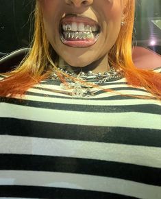 Women’s Grill Teeth, Women With Grillz Gold Teeth, Grillz Girls Teeth, 2 Piece Grillz, Gold Fangs Grillz