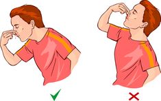 aiding a nosebleed #HeatherEarles #nosebleeds #blood #treatmentsandprevention Parts Of The Nose, Top 10 Home Remedies, Nose Bleeds, Difficulty Breathing, Health Dinner Recipes, Homemade Remedies, Natural Treatments, Life Cycles, First Aid