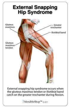 Snapping Hip Syndrome, Psoas Iliaque, Hip Flexor Pain, Greater Trochanter, Psoas Release, Hip Flexor Exercises, Hip Flexor Stretch, It Band