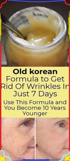 Wrinkles Remedies Face, Get Rid Of Wrinkles, Wrinkle Remedies, Skin Care Wrinkles, Face Wrinkles, Beauty Remedies, Skin Care Remedies, Beauty Recipe, Years Younger