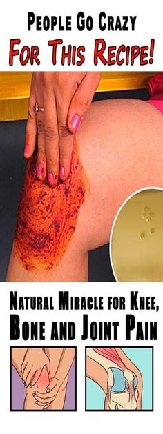 People Are Going Crazy About This Recipe! It Can Heal Your Joint, Bone And Knee Pain! Knee Bones, Joints Pain Remedy, Go Crazy, Natural Medicine, Health Remedies, Diet Tips