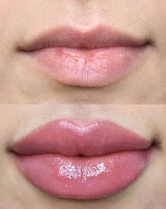 Botox Lips, Tattoo Techniques, Tattoo Prices