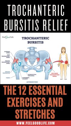 The 12 Essential Exercises and Stretches for Trochanteric Bursitis Relief Sciatica Exercises, Lower Back Pain Exercises