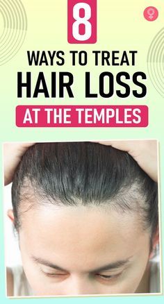 Hair Shedding Remedies, Herbs For Hair, Hair Growth Supplement, Lost Hair