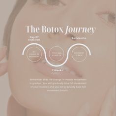 Botox is not an instant result service. It takes about two weeks to kick in and will last 3-4 months. DM Us any questions ✉️ #botox #nycinjector #fillers #nymedspa #queensinjector Botox And Fillers Aesthetic, Med Spa Instagram Story Ideas, Botox Social Media Post, Botox Inspiration, Botox Facts, Content Ideas Beauty, Botox Benefits, Botox Aesthetic, Aesthetics Nurse