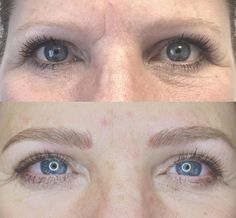 Eyebrow Tinting Before And After Blonde, Eyebrow Tinting Vs Microblading, Eyebrows Blonde Hair, Blonde Hair Microblading Eyebrows, Microblading For Blondes, Blonde Microblading, Eyebrows Blonde, Ombre Powder Brows