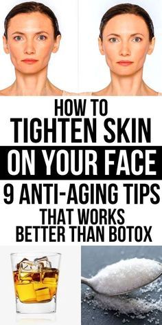 Natural Wrinkle Remedies, Tighten Facial Skin, Wrinkle Remedies, Anti Aging Vitamins, Connective Tissue, Glow Skin, Wrinkled Skin, Anti Aging Tips, Deep Wrinkles