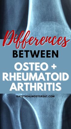 what's the difference between osteoarthritis and rheumatoid arthritis, arthritis, osteoarthritis, rheumatoid arthritis, ra, rheum, rheumatoid disease, arthritis tips, who can get arthritis, osteoarthritis symptoms, rheumatoid arthritis symptoms Rheumatoid Pain Relief, Rheumatoid Symptoms, Ra Symptoms, Carpel Tunnel, Fatigue Symptoms, Ab Fab, Polycystic Ovarian Syndrome, Sciatic Nerve Pain