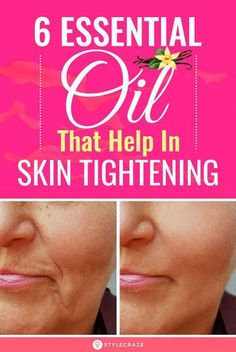 As much as we all hate aging, it is an inevitable part of our life. As years pass, and as we keep celebrating our birthdays every year, we know that we are aging. And how can someone know if you are approaching old age without knowing your date of birth? Best Essential Oils For Skin Tightening, Facial Skin Tightening Remedies, Facial Masks Homemade Anti Aging Skin Tightening, Essential Oils For Deep Wrinkles, Oils To Tighten Skin, Firming Oils Skin Tightening, Homemade Skin Tightening Cream, How To Tighten My Face Skin, Best Oils For Skin Anti Aging