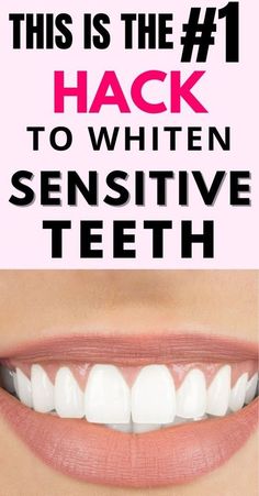 gentle dental care Whiten Teeth Fast, Teeth Whitening Methods, Teeth Whitening Diy, Perfect Teeth, Whiten Teeth, Tooth Sensitivity, Gum Health, Health Habits