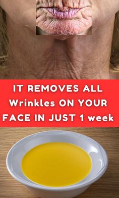 IT REMOVES ALL Wrinkles ON YOUR FACE IN JUST 1 week #WrinkleFreeLiving #RadiantBeauty #ForeverFlawless #GlowingYouth #YouthfulSkinGoals Natural Anti Wrinkle Skin Care, Best Natural Wrinkle Remedy, How To Avoid Wrinkles On Face, Best Foundation For Wrinkles, All Natural Wrinkle Remedies, Eyelid Wrinkles, Wrinkle Prevention