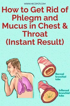 Mucus In Chest, Getting Rid Of Mucus, Chest Congestion Remedies, Getting Rid Of Phlegm, Home Remedies For Bronchitis, Sick Remedies, Back Pain Remedies