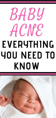 baby acne everything you need to know