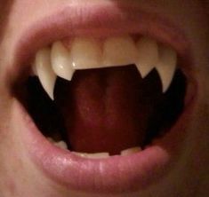 a person with their mouth open showing teeth