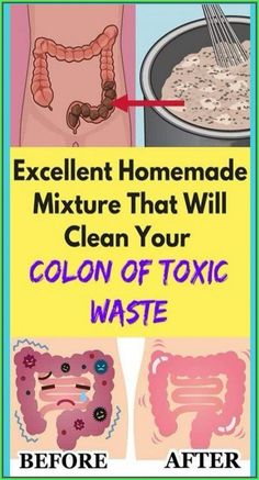 HOMEMADE MIXTURE THAT WILL CLEAN YOUR Healthy Colon, Too Much Estrogen, Toxic Waste, Colon Health, Egg Diet, Creating A Newsletter, Health Remedies, Baking Soda