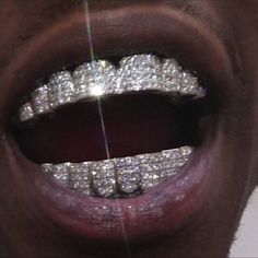 Mouth Grillz, Grillz Teeth, Diamond Grillz, Diamond Teeth, Gold Grillz, Grills Teeth, Fashion Boy, Tooth Gem, Gold Teeth