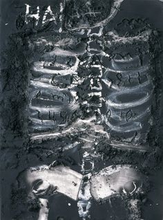 an x - ray image of a skeleton in black and white with writing on it