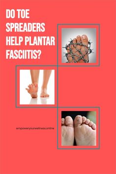 Toe spreaders might be one of the plantar fasciitis stretches you haven't tried. Read the full article to find out how using toe separators can help you find heel pain relief. Toe Spacers Benefits, Toe Spacers, Heel Pain Relief, Foot Pain Relief, Gel Toes, Heel Pain, Foot Pain, Wellness Tips, Simple Tricks