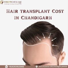 In this blog, we'll explore the world of hair transplants and shed light on the Hair Transplant Cost In Chandigarh at Cosmo Care & Hair Clinic.