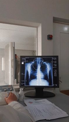 a person laying in bed looking at an x - ray image on the computer screen