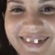 a close up of a woman's face with white teeth and missing toothpaste