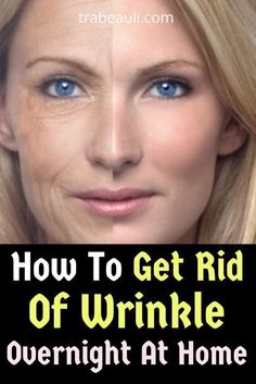 Japanese Secret To Look 10 Years Younger Than Your Age #japanesesecret #antiagingtreatment #look10yearyounger #getglowingskin #getridofwrinkles #wrinkleremovalmask #facepack #undereyewrinkles #lookingyoung #youthfulskin #frkitchen Get Rid Of Wrinkles, Eye Wrinkles, Health Podcast, Deep Wrinkles