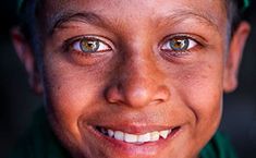 a close up of a person wearing a green shirt and smiling with his eyes wide open