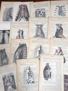 an old book with medical diagrams on it