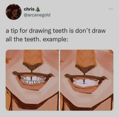 two pictures of the same person's teeth